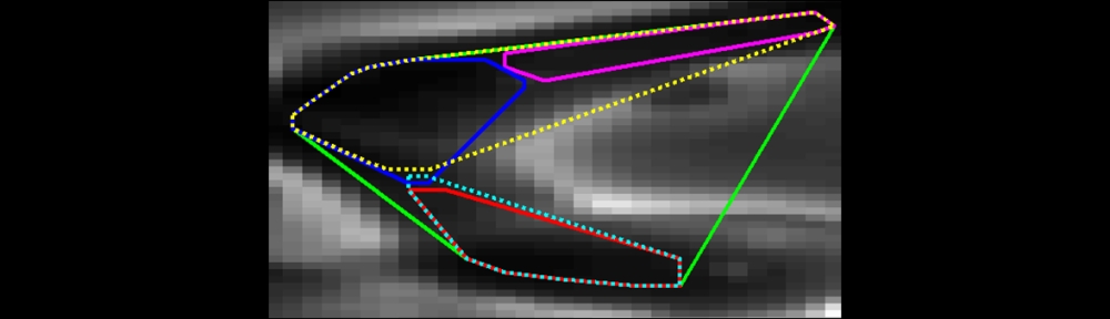 computational image sequence analysis